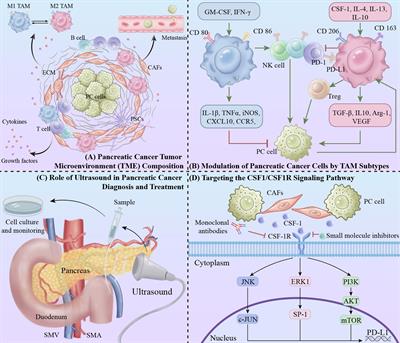 Targeting the CSF1/CSF1R signaling pathway: an innovative strategy for ultrasound combined with macrophage exhaustion in pancreatic cancer therapy